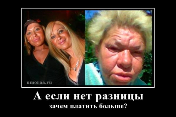 фото до и после пластической операции лица